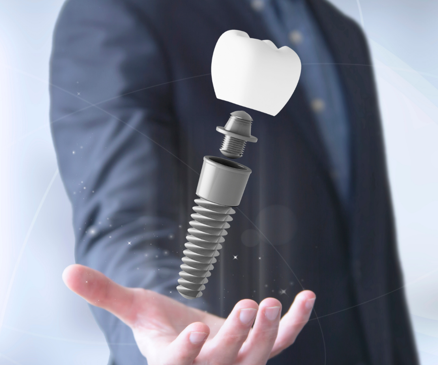 implante dental